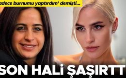 ‘Sadece burnumu yaptırdım’ demişti, son hali şaşırttı: Ne kadar güzelsiniz, doktorunuz kim?